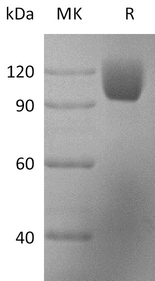 Rhesus Macaque ICAM-1 +SDS-PAGE-1.jpg